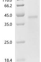 Human Latent-transforming growth factor beta-binding protein 4 (LTBP4), partial Recombinant Protein - BioCrest Sci