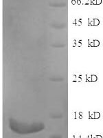 Rat Phospholipase A2, membrane associated (Pla2g2a) Recombinant Protein, N-His-SUMO - BioCrest Sci