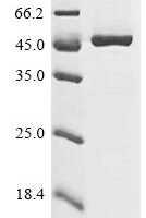 Human Acyl-coenzyme A thioesterase 9, mitochondrial (ACOT9) Recombinant Protein, C-His, aa 22–439, Yeast - BioCrest Sci