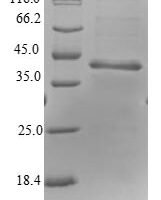 Human Ribonuclease P protein subunit p25-like protein (RPP25L) Recombinant Protein - BioCrest Sci