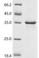 Human Transcriptional enhancer factor TEF-4 (TEAD2), partial Recombinant Protein, C-10His - BioCrest Sci