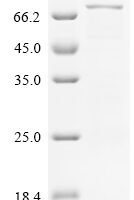 Human Target of rapamycin complex 2 subunit MAPKAP1 (MAPKAP1) Recombinant Protein, C-His - BioCrest Sci
