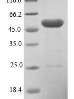Human Pleckstrin homology-like domain family A member 1 (PHLDA1) Recombinant Protein - BioCrest Sci