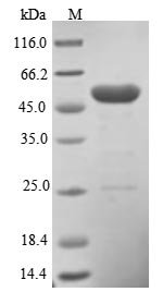 Human Pleckstrin homology-like domain family A member 1 (PHLDA1) Recombinant Protein, Homo sapiens (Human), E.coli, N-terminal 6xHis-tagged, 50.5 kDa, purity >≥ 85% as determined by SDS-PAGE.