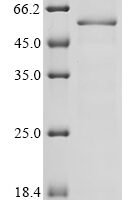Mouse Cytochrome P450 2E1 (Cyp2e1), partial Recombinant Protein, N-His, aa 2–493, E.coli - BioCrest Sci