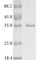 Porcine parvovirus Initiator protein NS1 (NS1), partial Recombinant Protein - BioCrest Sci