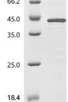 Epstein-Barr virus Epstein-Barr nuclear antigen 6 (EBNA6), partial Recombinant Protein - BioCrest Sci