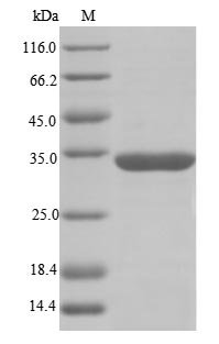 Human RNA-binding motif protein, X chromosome (RBMX), partial Recombinant Protein, Homo sapiens (Human), E.coli, N-terminal GST-tagged, 33.4 kDa, purity >≥ 85% as determined by SDS-PAGE.