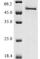 Human Ribonuclease inhibitor (RNH1) Recombinant Protein, N-10His/C-Myc - BioCrest Sci