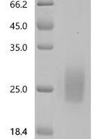 Human Seizure protein 6 homolog (SEZ6), partial Recombinant Protein, C-10His, aa 528–591, Mammalian cell - BioCrest Sci