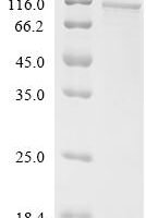 Human Protein mono-ADP-ribosyltransferase PARP9 (PARP9) Recombinant Protein - BioCrest Sci