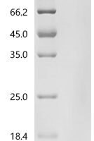 Mouse Protein Wnt-2 (Wnt2) Recombinant Protein - BioCrest Sci