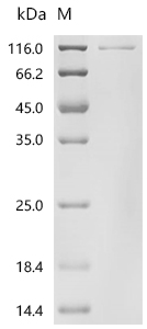 Mouse Protein Wnt-2 (Wnt2) Recombinant Protein, Mus musculus (Mouse), Mammalian cell, N-terminal HSA-tagged and C-terminal 10xHis-tagged, 105.5 kDa, purity >≥ 95% as determined by SDS-PAGE.