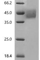 Mouse Tumor-associated calcium signal transducer 2(Tacstd2), partial Recombinant Protein - BioCrest Sci