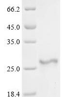 Human Adrenodoxin, mitochondrial (FDX1) Recombinant Protein - BioCrest Sci