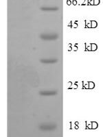 Human Inosine-5'-monophosphate dehydrogenase 2 (IMPDH2), partial Recombinant Protein - BioCrest Sci