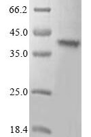 Mouse Toll-like receptor 7 (Tlr7), partial Recombinant Protein, N-10His/C-Myc, aa 27–348, Mammalian cell - BioCrest Sci