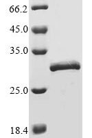 Human COMM domain-containing protein 5 (COMMD5) Recombinant Protein, N-10His/C-Myc, aa 2–224, Baculovirus - BioCrest Sci