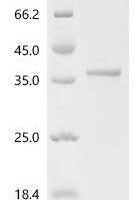 Human Immunoglobulin J chain (JCHAIN) Recombinant Protein, N-His-SUMO - BioCrest Sci
