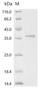 Human Immunoglobulin J chain (JCHAIN) Recombinant Protein, N-His-SUMO, Homo sapiens (Human), E.coli, N-terminal 6xHis-SUMO-tagged, 28.5 kDa, purity >≥ 85% as determined by SDS-PAGE.