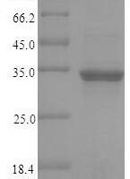 Human Coiled-coil domain-containing protein 3 (CCDC3) Recombinant Protein - BioCrest Sci