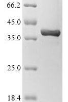 Mouse Non-receptor tyrosine-protein kinase TYK2 (Tyk2), partial Recombinant Protein - BioCrest Sci