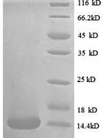 Human C-C motif chemokine 24 (CCL24) Recombinant Protein, N-His - BioCrest Sci