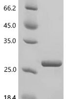 Human Ubiquitin-like FUBI-ribosomal protein eS30 fusion protein (FAU) Recombinant Protein, C-His - BioCrest Sci