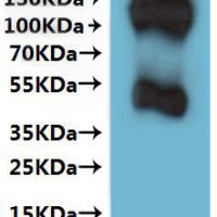 Human Somatostatin receptor type 3 (SSTR3)-VLPs Recombinant Protein - BioCrest Sci