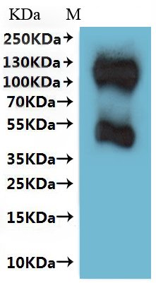 Human Somatostatin receptor type 3 (SSTR3)-VLPs Recombinant Protein, Homo sapiens (Human), Mammalian cell, C-terminal 10xHis-tagged(This tag can be tested only under denaturing conditions), 47.2 kDa, purity >The purity information is not available for VLPs proteins.