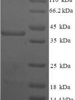 Human Homeobox protein TGIF2LX (TGIF2LX) Recombinant Protein - BioCrest Sci