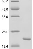 Rat Tumor necrosis factor (Tnf), partial, Biotinylated Recombinant Protein - BioCrest Sci