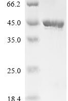 Aspergillus niger Aspergillus niger contig An12c0300, genomic contig (An12g08930) Recombinant Protein - BioCrest Sci