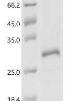 Human Zinc finger HIT domain-containing protein 3 (ZNHIT3) Recombinant Protein - BioCrest Sci