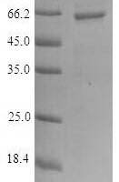 Human DNA primase small subunit (PRIM1) Recombinant Protein - BioCrest Sci