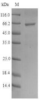 Human DNA primase small subunit (PRIM1) Recombinant Protein, Homo sapiens (Human), E.coli, N-terminal 6xHis-SUMO-tagged, 65.9 kDa, purity >≥ 90% as determined by SDS-PAGE.