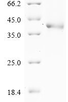 Human Serine protease 1 (PRSS1), partial Recombinant Protein - BioCrest Sci
