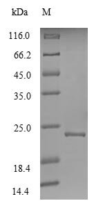 Hepatitis E virus genotype 1 Non-structural polyprotein pORF1 (ORF1), partial Recombinant Protein, Hepatitis E virus genotype 1 (isolate Human/Pakistan/Sar-55) (HEV-1), E.coli, N-terminal 6xHis-tagged, 24.4 kDa, purity >≥ 90% as determined by SDS-PAGE.