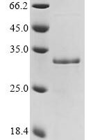 Mouse Galectin-3 (Lgals3) Recombinant Protein - BioCrest Sci