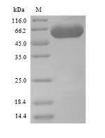 Saccharomyces cerevisiae Serine--tRNA ligase, Cytoplasmic domain (SES1) Recombinant Protein, N-His, aa 1–462, Yeast, Saccharomyces cerevisiae (strain ATCC 204508 / S288c) (Baker's yeast), Yeast, N-terminal 6xHis-tagged, 55.3 kDa, purity >≥ 90% as determined by SDS-PAGE.