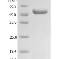 Human Succinyl-CoA ligase [GDP-forming] subunit beta, mitochondrial (SUCLG2), partial Recombinant Protein - BioCrest Sci