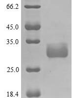 Human Large proline-rich protein BAG6 (BAG6), partial Recombinant Protein - BioCrest Sci