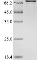 Rat Neurofilament light polypeptide (Nefl) Recombinant Protein - BioCrest Sci
