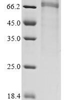 Human Protein Wnt-4 (WNT4) Recombinant Protein, C-hFc1 - BioCrest Sci