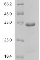 Human Synaptic vesicle glycoprotein 2A (SV2A), partial Recombinant Protein - BioCrest Sci