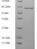Acetobacter pasteurianus Modification methylase ApaLI (apaLIM) Recombinant Protein, N-His-SUMO - BioCrest Sci