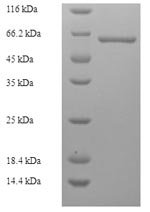 Acetobacter pasteurianus Modification methylase ApaLI (apaLIM) Recombinant Protein, N-His-SUMO, Acetobacter pasteurianus (Acetobacter turbidans), E.coli, N-terminal 6xHis-SUMO-tagged, 62.5 kDa, purity >≥ 90% as determined by SDS-PAGE.