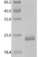 Human Secreted frizzled-related protein 2 (SFRP2),partial Recombinant Protein - BioCrest Sci