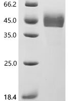 Human Insulin-like growth factor-binding protein 3 (IGFBP3), Biotinylated Recombinant Protein - BioCrest Sci