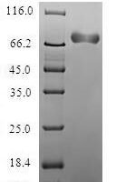 Human Acidic mammalian chitinase (CHIA) Recombinant Protein - BioCrest Sci